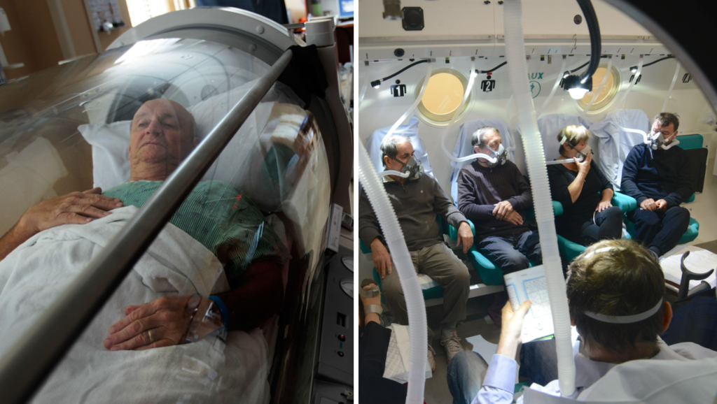 Hyperbaric Oxygen